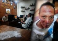 Kasus Dugaan Penganiayaan terhadap Pimpinan Redaksi BantenNet Masih Didalami Polisi, Korban Jalani Visum di RS Columbia BSD